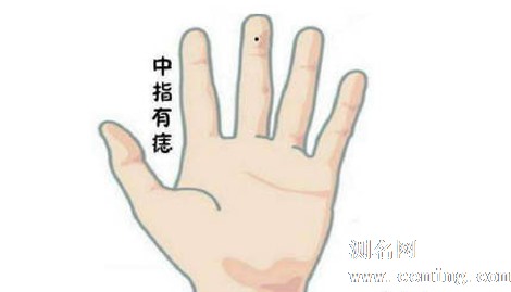 男人左手中指有痣图解 左手有痣代表了什么