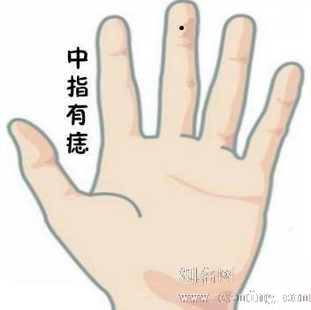 右手中指有痣有什么说法 中指有痣好吗